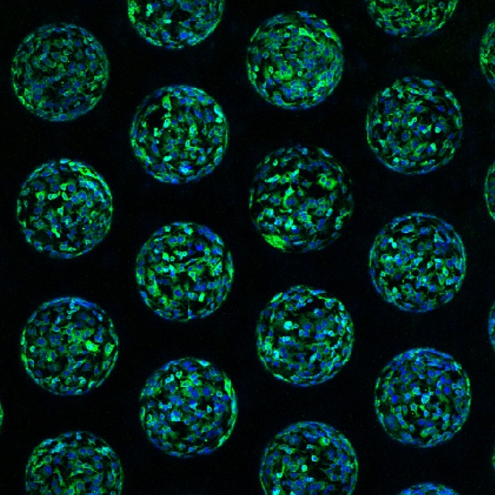 The photo shows several spherical 3D aggregates of green glowing cells. The cell nucleus is labelled blue.