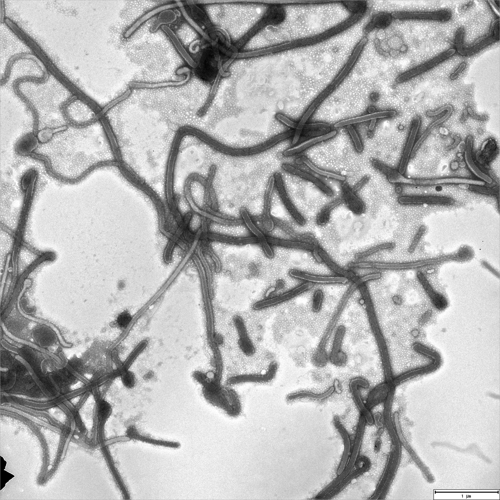 Elektronenmikroskopische Aufnahme von Ebolaviren aus dem aktuellen Ausbruch der Krankheit.