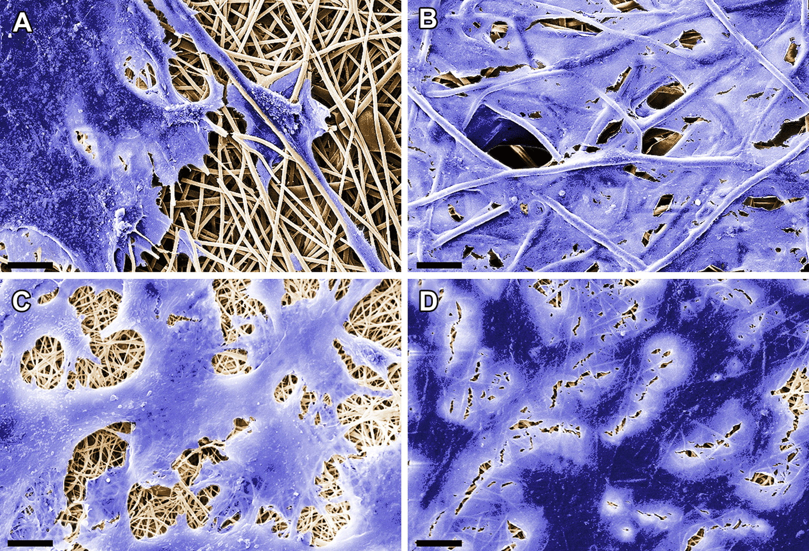 Four scanning electron microscope images of fibrous structures (beige) on which cells (purple, planar structure) can adhere and grow. (A) Valve interstitial cells (VIC) grown on a polylactide scaffold. (B) Valve endothelial cells (VEC) on a polylactide sc