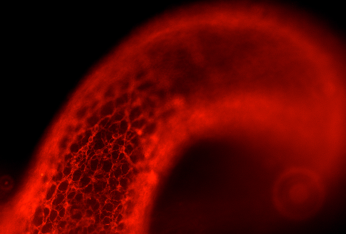Immunofluorescence image of the enteric nervous system in a mouse. The red fluorescing neurons form a complex network in the intestinal wall.
