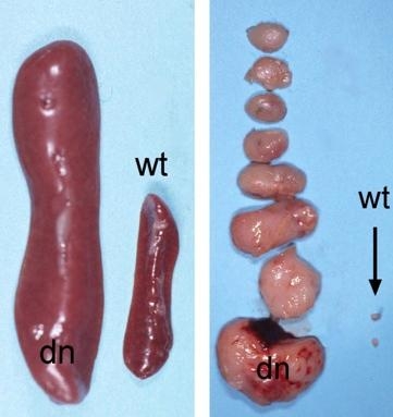 Zu sehen sind im linken Teilbild eine vergrößerte und eine normale Mausmilz, und im rechten Teilbild vergrößerte und normale Maus-Lmyphknoten