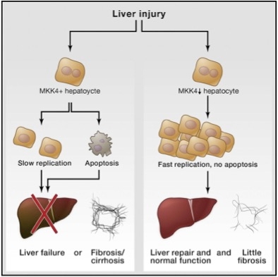 The diagram highlights the importance of the MKK4 kinase enzyme in people with liver injury. Activation of MKK4 can lead to hepatic failure and death, or severe fibrosis. This is shown on the left-hand side of the diagram. Inhibition of MKK4 accelerates t