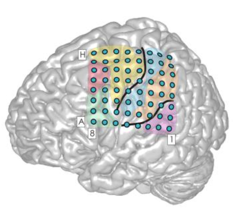 The photo shows a schematic of the brain with electrodes arranged in a coordinate system.