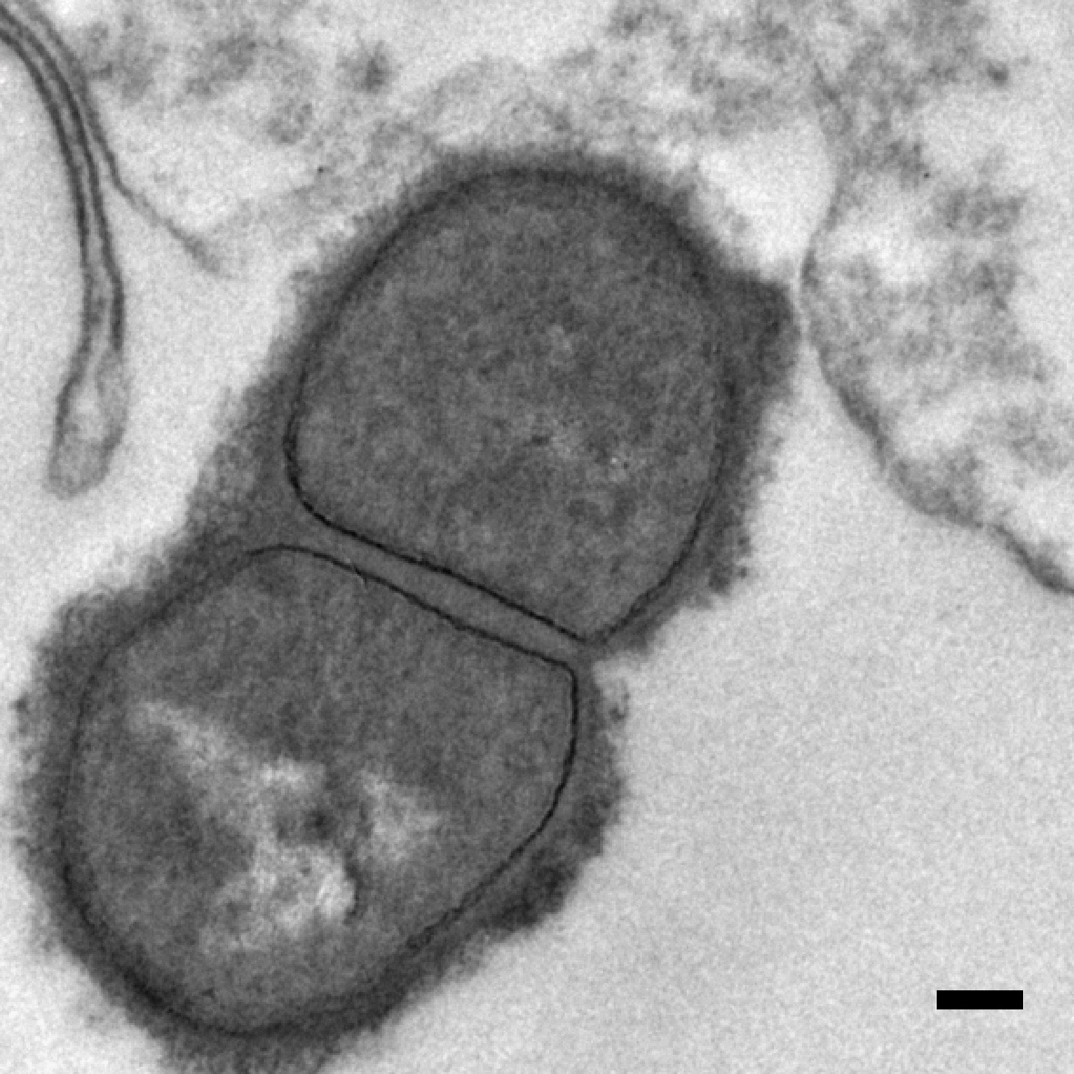 B/w electron microscope image of a Lactobacillus rhamnosus bacterium that is in contact with a keratinocyte (measuring bar = 0.1).
