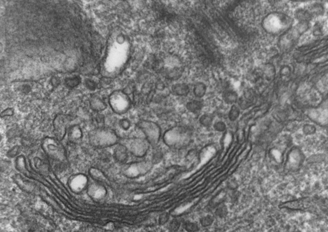 Electron microscope image showing the compartment stacks of a Golgi apparatus.