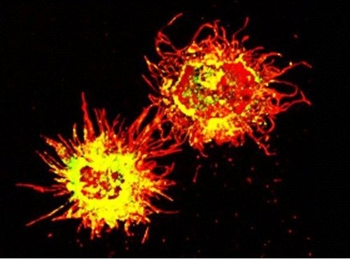 Immunofluorescence image of two dendritic mouse cells with MHC complexes (labelled with red-fluorescent antibodies) on their surface.