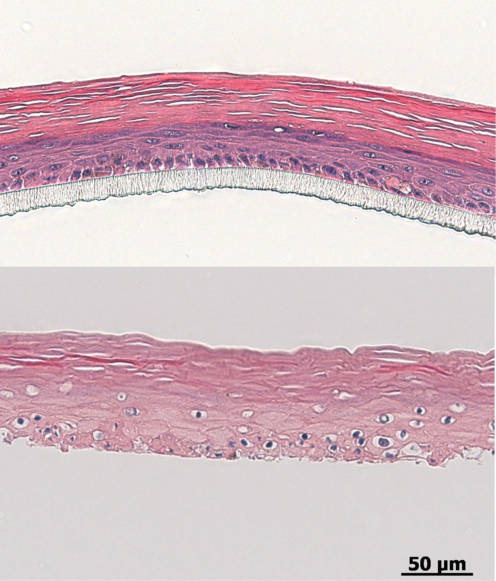 Es ist jeweils ein histologischer Querschnitt durch die Epidermis vor(oben) und nach der Bestrahlung (unten) zu sehen. Auf dem unteren Schnitterscheint die Epidermis aufgrund der Zellschädigung ausgefranst undlöchrig.