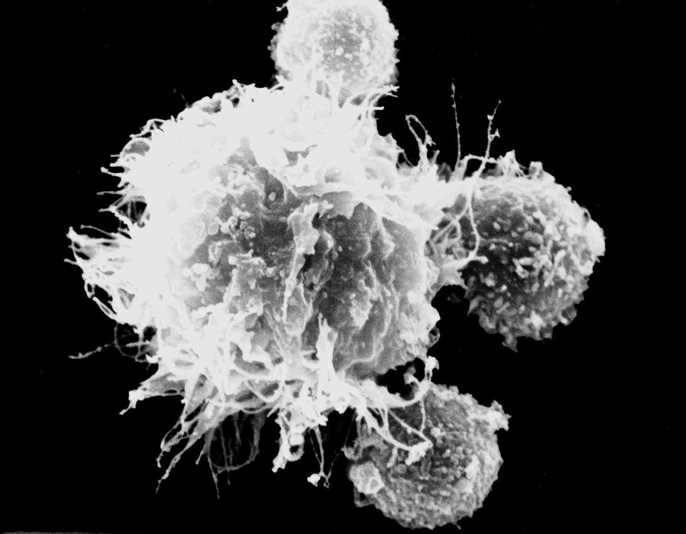 Zu sehen ist eine größere dendritische Zellen, die zwei kleinere lymphozytische Zellen erkannt und gebunden hat.