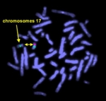 Zu sehen sind violett leuchtende Chromosomen. Ein Chromosom hat eine grün markierte, ein anderes eine grün und eine rosa markierte Region.