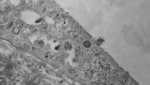 Die elektronenmikroskopische Aufnahme zeigt ein Nierenarterien-Organmodell. In dieser kulitivierten Zelle ist sehr deutlich der kugelige und stachelige Körper des Virus erkennbar.