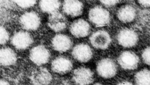 Photo showing an electron microscope image of adeno-associated viruses (AAV).