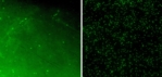 Abwehrschutz: Die Mikroskop-Aufnahmen zeigen, dass sich auf beschichteten Implantat-Stückchen (linkes Bild) deutlich weniger Bakterien ansiedeln (weniger grüne Punkte) als auf unbeschichteten (mehr grüne Punkte).