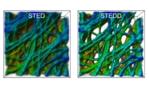 Zwei Mikroskop-Bilder einer Krebszelle. Das Bild auf der linken Seite (STED) weist eine niedrigere Auflösung auf als das rechte (STEDD).
