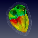 heart_contraction.jpg