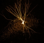 Zu sehen ist eine mikroskopische Darstellung von zwei Nervenzellen, die miteinander verbunden sind.