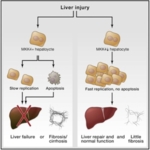 Die Grafik zeigt kontrastiv die Bedeutung der Kinase MKK4 bei Leberschädigung. Bleibt MKK4 aktiviert, führt dies im Fall der Leberschädigung zu Leberversagen, Tod oder schwerer Fibrose, was in der Illustration auf der linken Seite gezeigt wird. Bei blockierter MKK4 wird im Gegenteil die Vermehrung der Leberzellen beschleunigt, die Apoptose verhindert, die Leber regeneriert sich und allenfalls eine leichte Fibrose resulitiert daraus. Dieser Eingriff wird auf der rechten Seite der Illustration gezeigt.