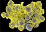 Die Falschfarbendarstellung zeigt einen Biofilm aus schleimartiger Substanz (gelb), die von rund 20 bis 30 kugelförmigen Bakterien (grau) ausgeschieden wird.