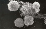 ZU sehen sind mehrere rundliche T-Lymphozyten, die an einer größeren dentritischen Zelle haften.