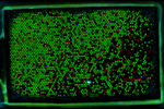 Bild eines Mikroarrays mit Punkten in verschiedenen Farben, die eine DNA-Sequenz darstellen.