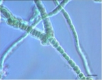 Zu sehen sind zu einem Faden angeordnete durchsichtige Bläschen vor einem blauen Hintergrund