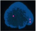 Blaues rundliches Gebilde auf schwarzem Hintergrund. Darin befinden sich 3 rosa-farbene Punkte.