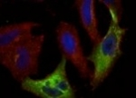 Funktionsweise eines Reportergens: Die Regulation durch microRNAs kann mittels fluoreszierender Proteine gemessen werden. Zu sehen sind mehrere Zellen, deren Zellkerne im Fluoreszenzmikroskop blau leuchten. Einige der Zellen leuchten an ihren Rändern rot, andere grün.