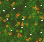Mikroskopische Aufnahme von rot gefärbten Immunzellen, die grün gefärbte Biofilme attackieren.
