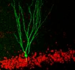 Die Abbildung zeigt in Grün die Rekonstruktion einer Körnerzelle eines Patienten, dessen Hippocampus zur Behandlung einer Temporallappenepilepsie operativ entfernt wurde. Rot sind die Zellkerne umliegender Körnerzellen markiert (mitProx1). Skalierung 100 µm.