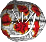 Network of brain areas.