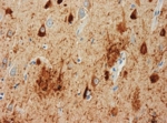 Deposition of tau protein fibrils in a mouse brain