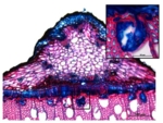 The photo shows a microscopic image of red and blue cells.