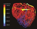 Computer generated model of the blood vessels of a human heart. The colors indicate a specific blood flow parameter.
