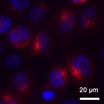 Zu sehen ist in einer Fluoreszenz-Aufnahme unter dem Mikroskop runde Ansammlungen in blauer Farbe, die die Zellkerne darstellen und rote Signale dicht daneben, die die Konjugate darstellen, all´ das vor schwarzem Hintergrund.
