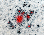 Hirnschnitt einer Alzheimer-Maus: Die Immunzellen sind schwarz, die Plaques rot und sternförmig.