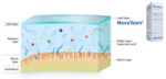 Schematic representation of the lipid layer that covers the eye, thus replacing the tear film.