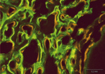 Das Bild zeigt grün leuchtende Knochenzellen, die sich im Scaffold genannten Gerüst für das Tissue Engineering neu gebildet haben.