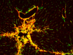 Zu sehen ist eine Mikroskopaufnahme von Lebergewebe. Ein zentraler Bereich leuchtet intensiv gelb-rot.