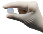 The ChondroFiller<sup>gel</sup> implant is a relatively form-stable matrix that can be implanted with a single minimally invasive procedure.