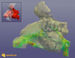 You can see a computer-based model of the nasal aera of a human with a ruptured nasal cartilage. Dots demonstrate the airflow while breathing out. Different sorts of velocities were measured.