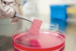 Stabile 3D-Matrix für die autologe Chondrozyten-Transplantation (Foto: BioTissue)