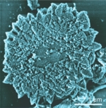Electron microscope image of crystalline precipitates secreted by Halomonas bacteria. The precipitates are stained blue.
