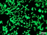Microscope image showing how cells that have taken up fluorescein glow when exposed to UV light.