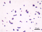 Mikroskopische Aufnahme von Staphylococcus aureus.