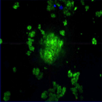 Fluorescence image where plaques are clearly visible.