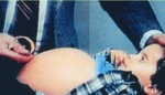 Abbildung zeigt Jungen mit vergrößertem Bauch, einem der Symptome der erblich bedingten und seltenen Stoffwechselkrankheit Gaucher