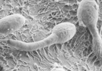 B/w electron microscope image of a fungus of the genus Candida.