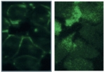 Zu sehen sind grün fluoreszierende "Flecken" auf schwarzem Hintergrund.