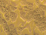 Microscope image of fully differentiated fat cells.