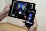 A tablet computer and a smartphone with a medical image.