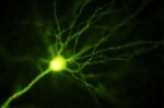 Zu sehen ist ein grün leuchtendes Neuron gegen einen schwarzen Hintergrund.